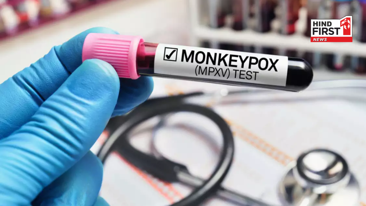 WHO Declares Monkeypox a Public Health Emergency: Key Symptoms and What You Need to Know