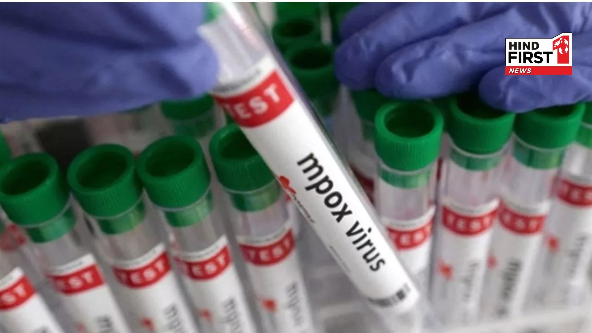 First patient of dangerous strain of Mpox found in India: WHO had declared it a health emergency