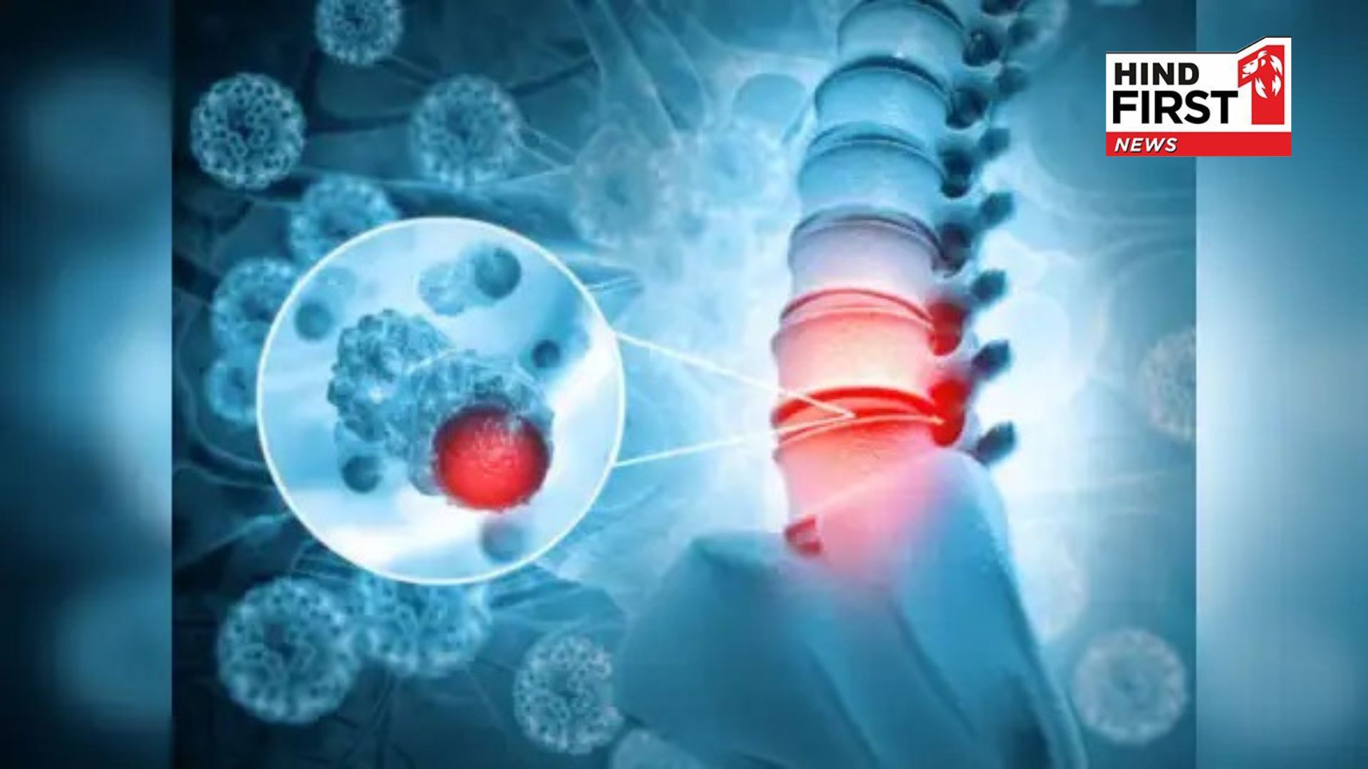 For bone strengthen eat these things daily after 30 For bone strengthen eat these things daily after 30