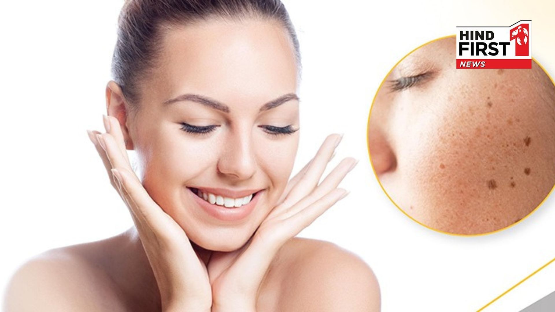 Best Remedies For Pigmentation, This will Reduce Your Dark Spots