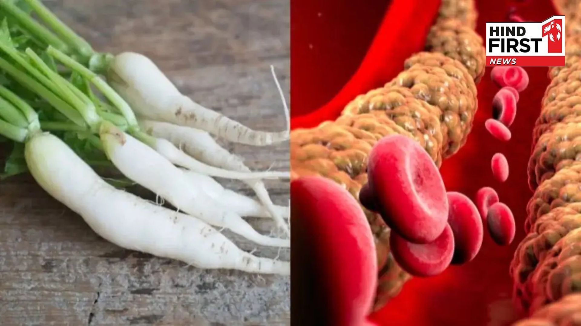 Bad cholesterol stuck in your veins will be removed, just do this every day.