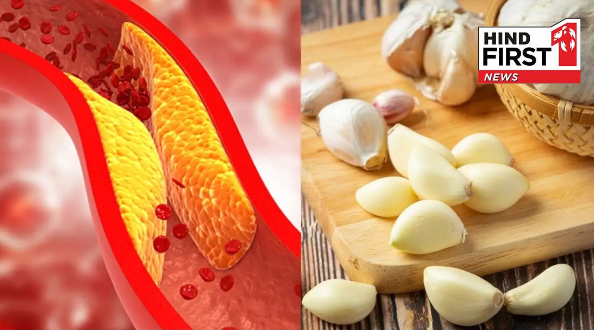 Kashmiri garlic is a natural remedy for cholesterol