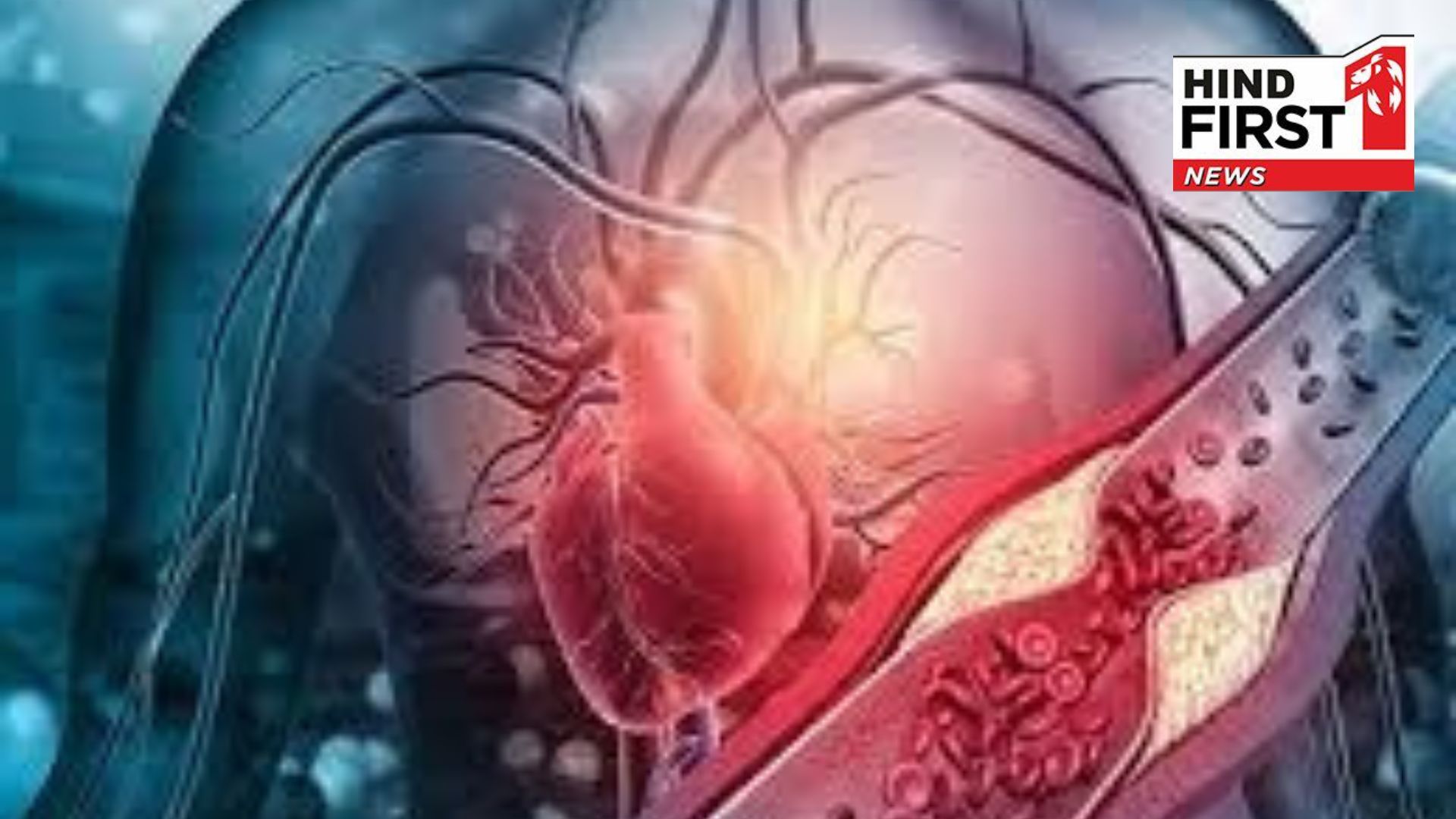 Does rising pollution increase the risk of heart attack?